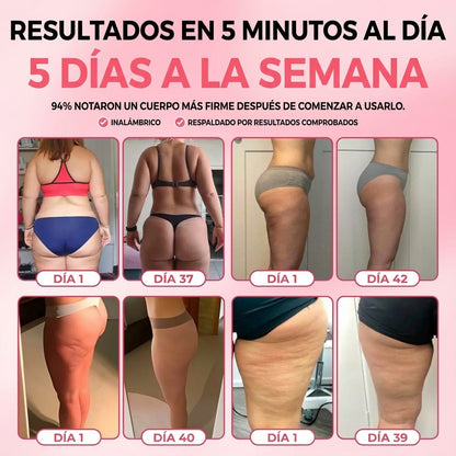 Kit LeaPretty™ para aliviar la celulitis