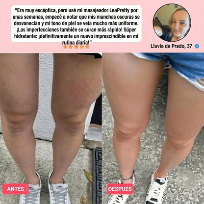 Kit LeaPretty™ para aliviar la celulitis